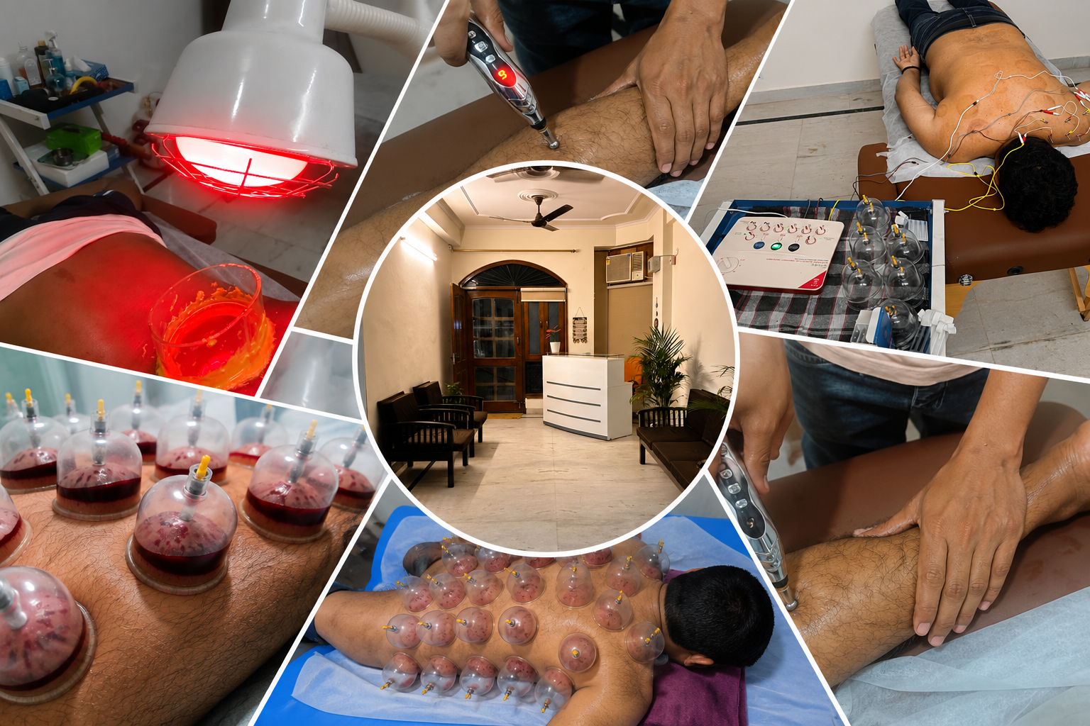 Acupressure and cupping therapy session at Avni Wellness Center, Sector 49 Barola, Noida